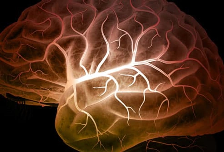 What Causes Epilepsy?