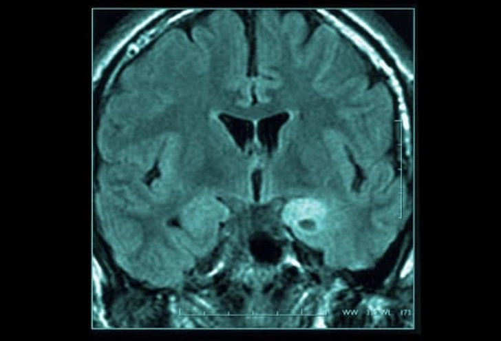 Diagnosis: Brain Scan