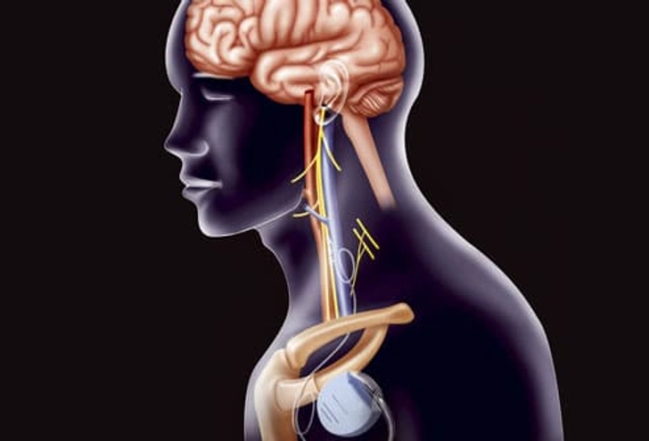 Treatment: Stimulation Therapies