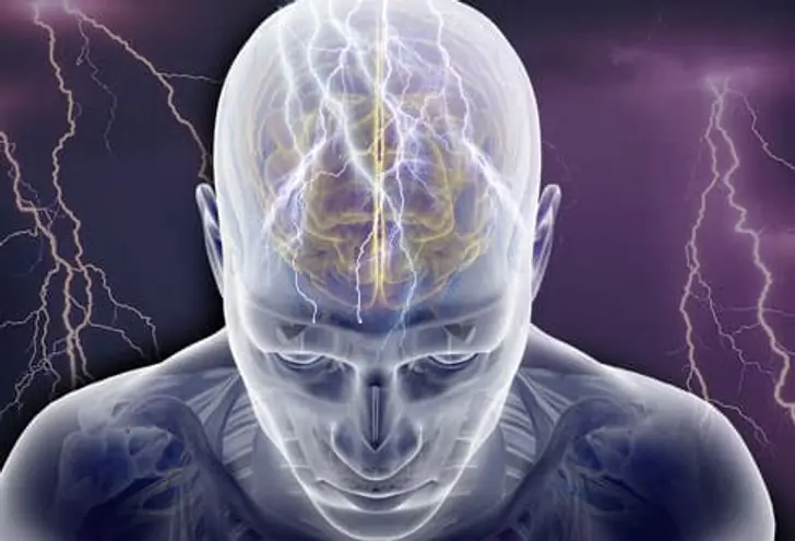 What Is Epilepsy?