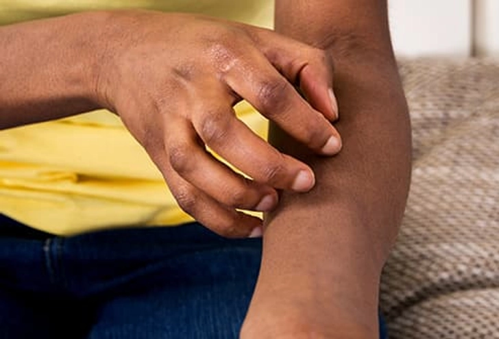 DO Stop Use if Your Skin Reacts