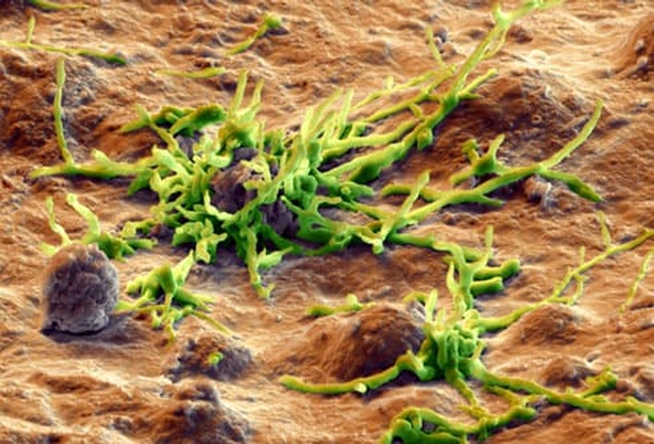 Go on Mold Patrol