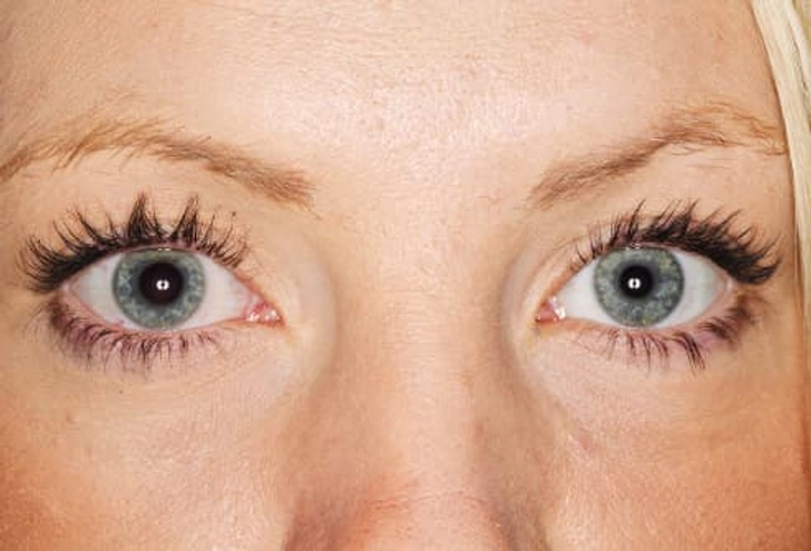 Different Dilations Different Dilations