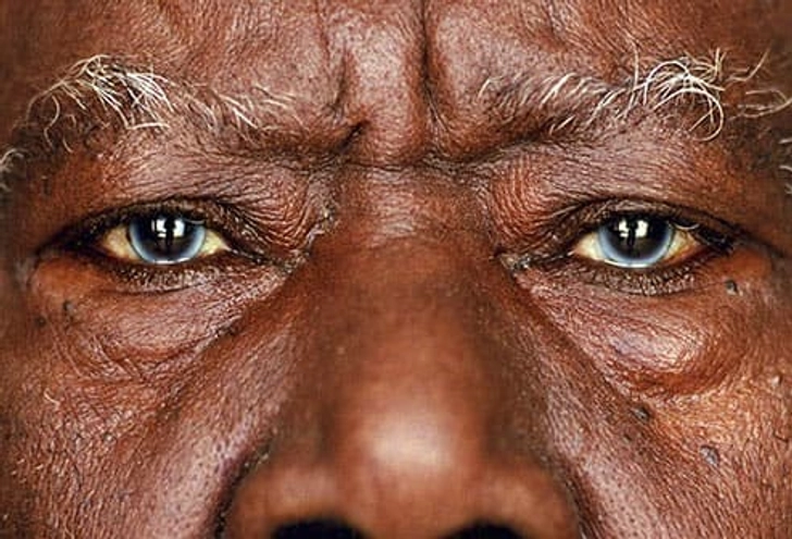 Multicolored Eyes Multicolored Eyes