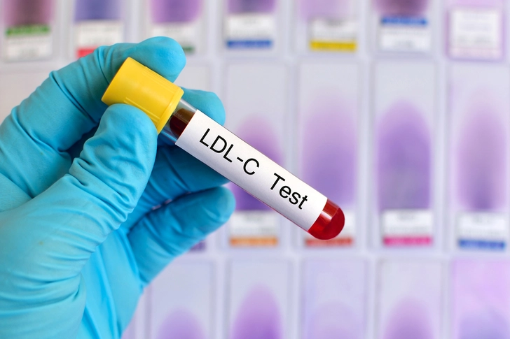 Lower Cholesterol