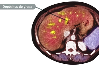 ¿Qué es?