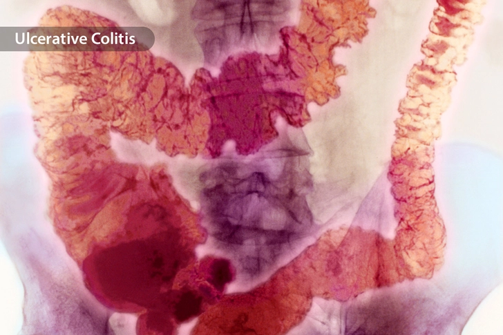 Ease Digestive Issues