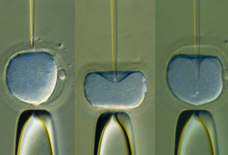 Treatments for Infertility