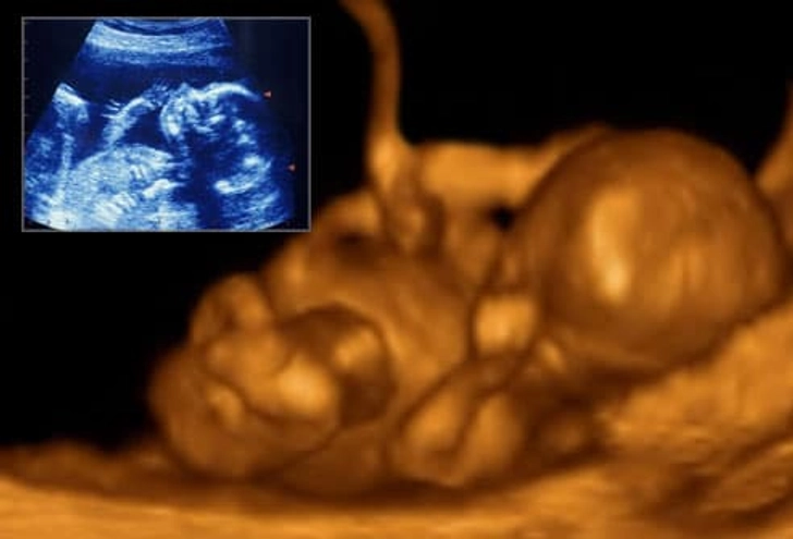 Time for an Ultrasound