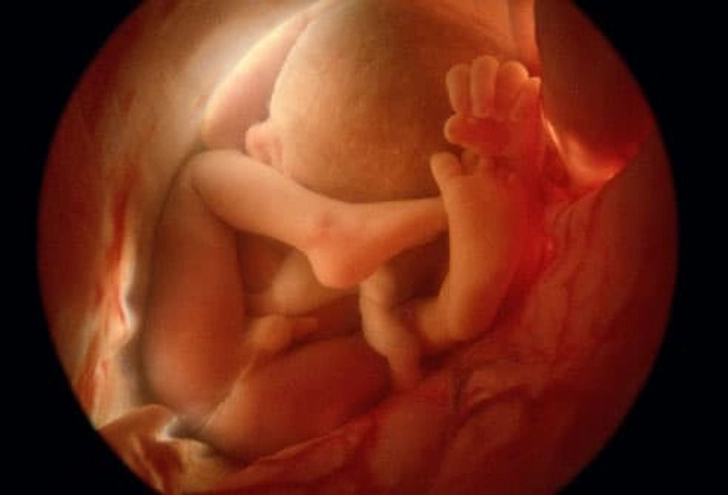 Development at 36 Weeks Development at 36 Weeks