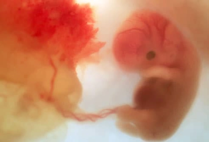 Development at 8 Weeks