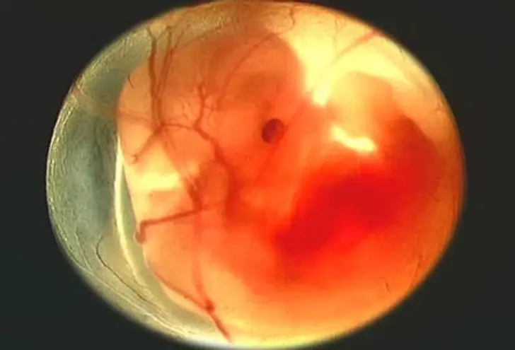 Your Pregnancy Stage by Stage Your Pregnancy Stage by Stage