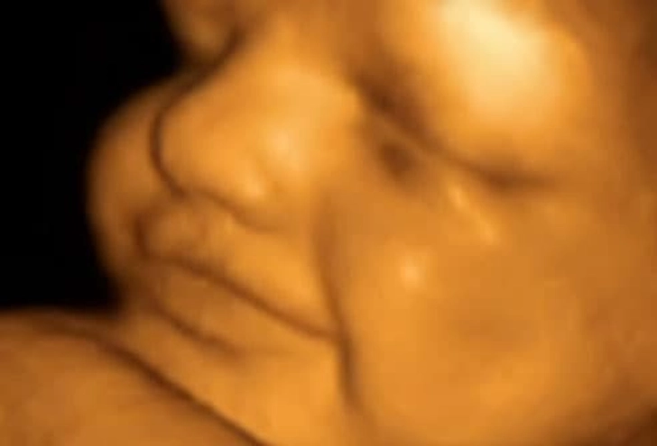 Development at 24 Weeks Development at 24 Weeks
