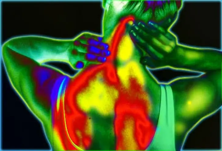 What Is Fibromyalgia?