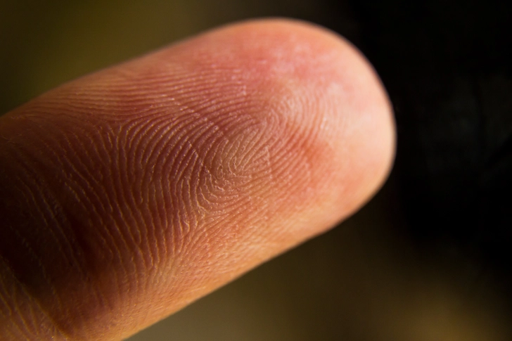 Do: Keep a Severed Finger Do: Keep a Severed Finger