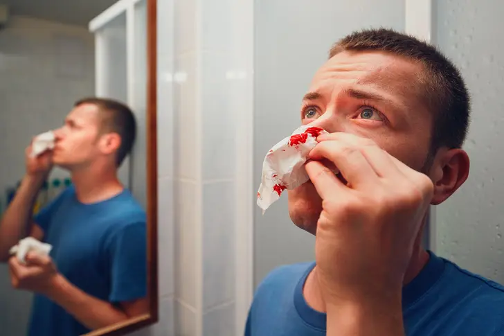 Don’t: Lean Back for Nosebleeds Don’t: Lean Back for Nosebleeds