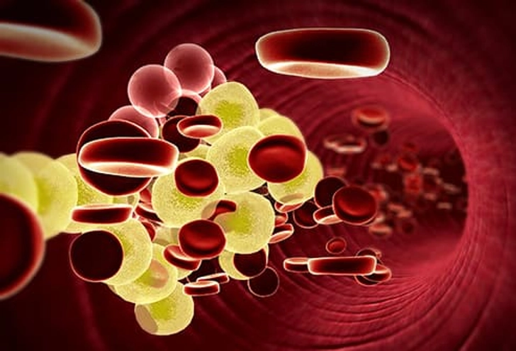 Bring Down Triglycerides Bring Down Triglycerides