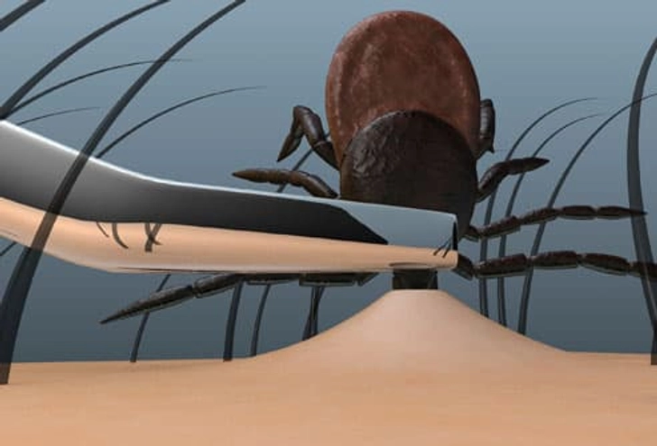 Safe Ways to Remove Ticks Safe Ways to Remove Ticks
