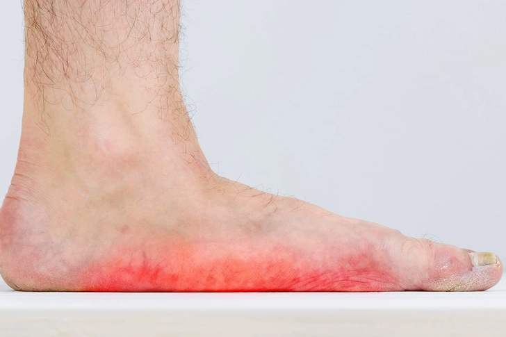 Flat Foot Flat Foot