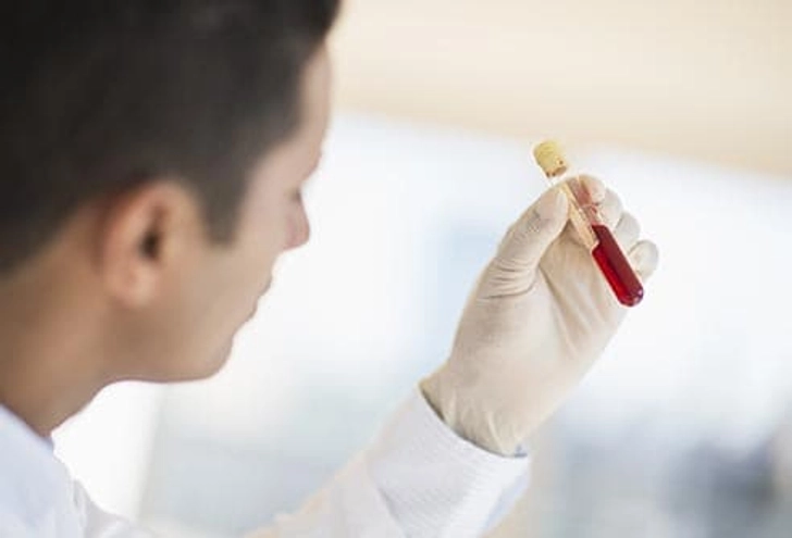 Diagnosing Hepatitis C