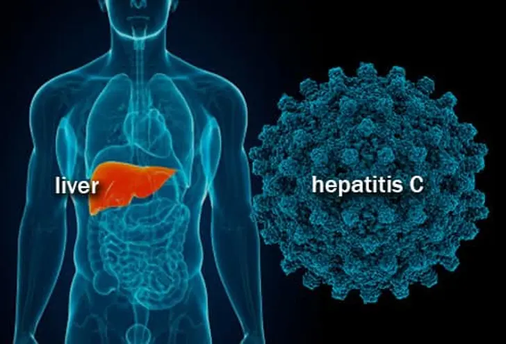 Hepatitis C: What Is It? Hepatitis C: What Is It?