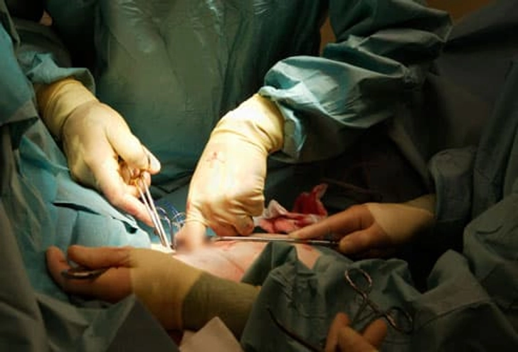 Risks of Surgery
