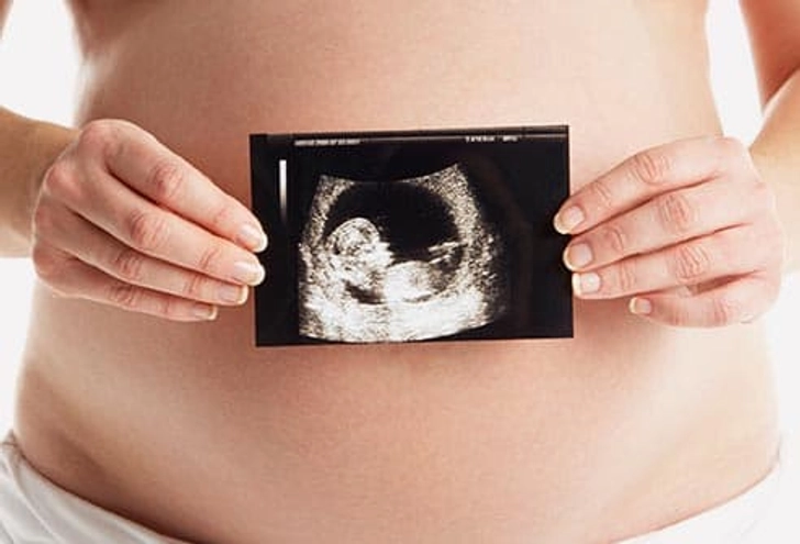 Herpes and Pregnancy