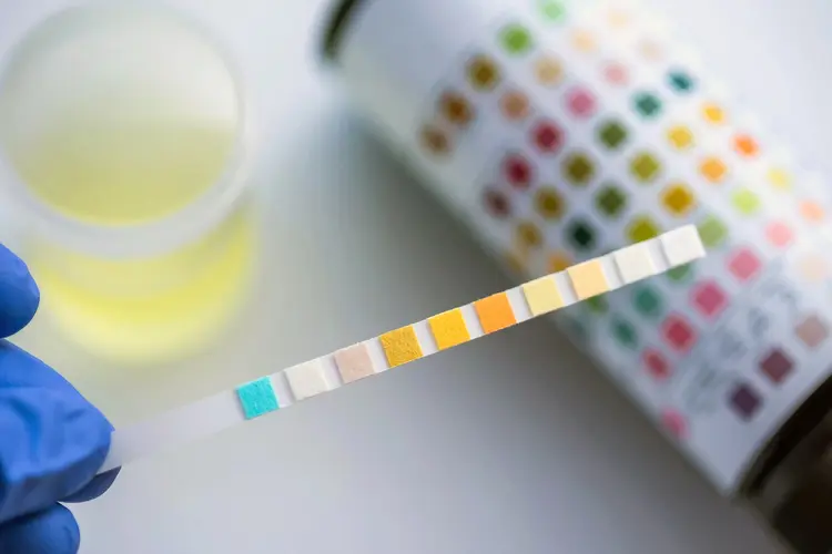 photo of urine test