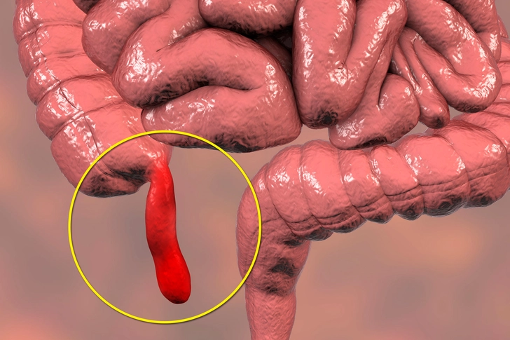 Lower Right Belly Pain