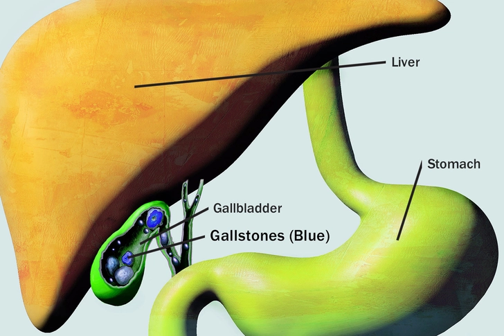 Pain in the Upper Part of Your Belly