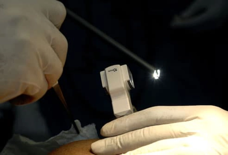 GIST Surgery GIST Surgery