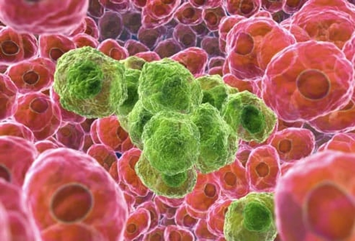 Is the Tumor Cancer? Is the Tumor Cancer?