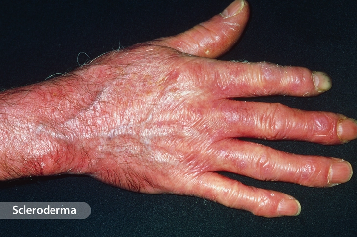 Common Underlying Conditions Common Underlying Conditions