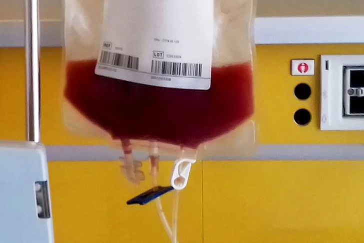 Treatment: Stem Cell Transplant