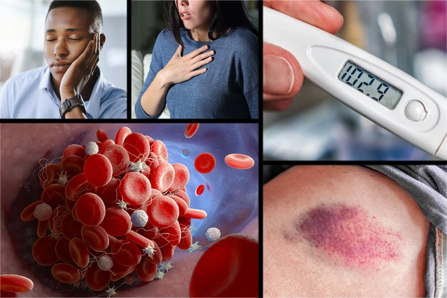 Symptoms of Blood Disorders