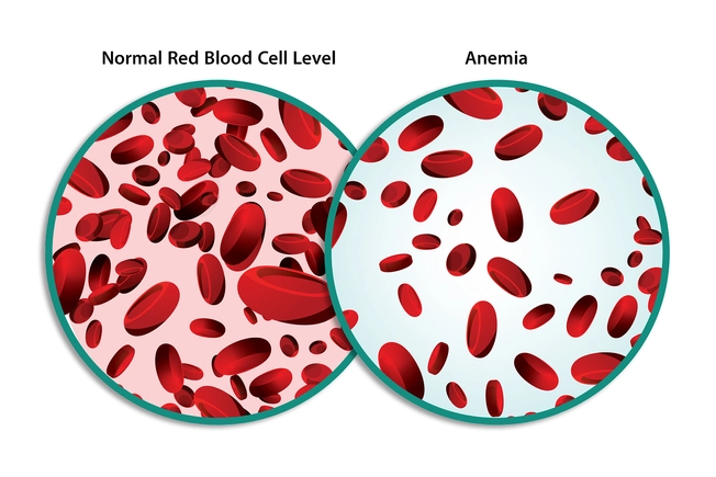 What happens in blood disorders?