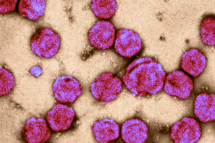 Leukemia Leukemia