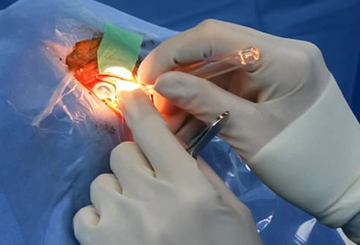 Treatment: Surgery