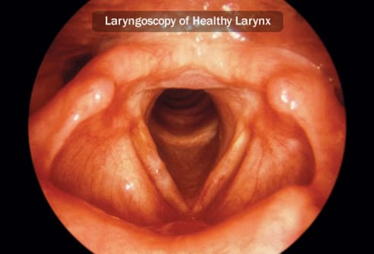 How Is Laryngeal Cancer Diagnosed? How Is Laryngeal Cancer Diagnosed?