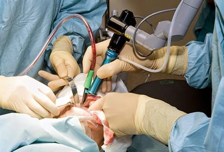 Treatment for Oral Cancer Treatment for Oral Cancer