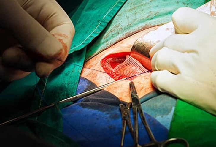 Treatment: Surgery Treatment: Surgery