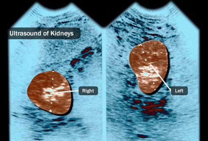 Diagnosis: Imaging Tests