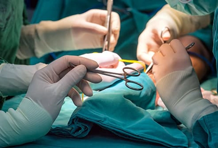 Surgery