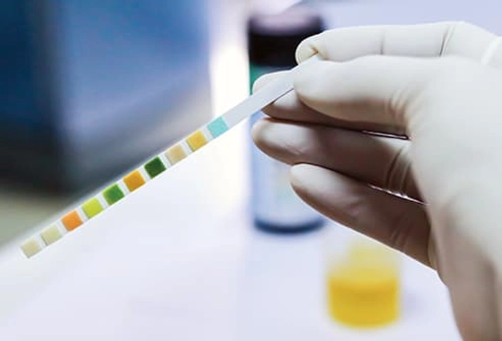 Diagnosis: Urine and Blood Tests