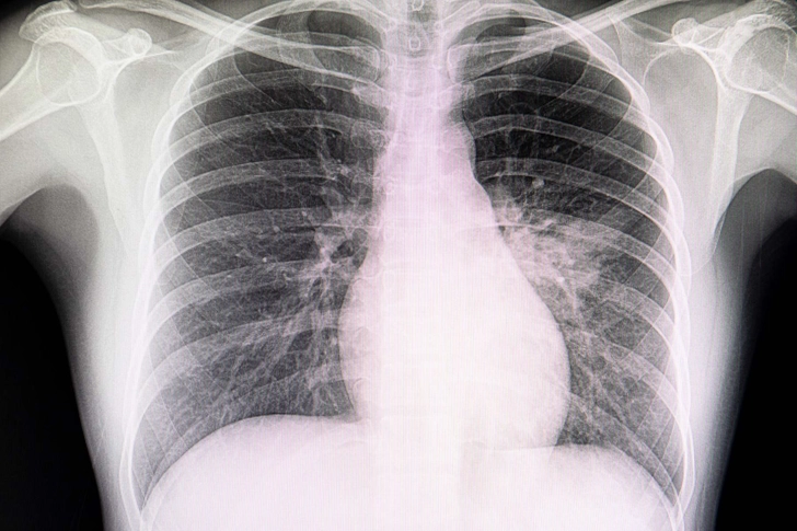 Diagnosis