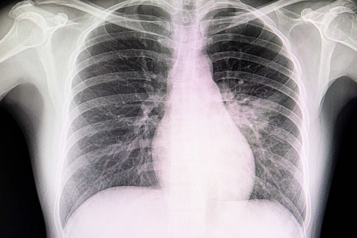 Diagnosis Diagnosis