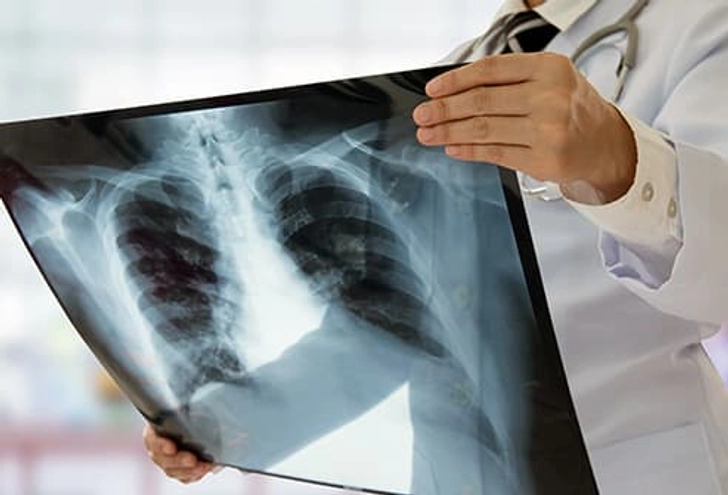 Diagnosis: Imaging Tests Diagnosis: Imaging Tests
