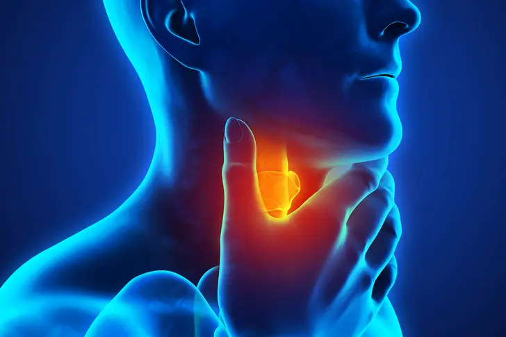 What Is Strep Throat?