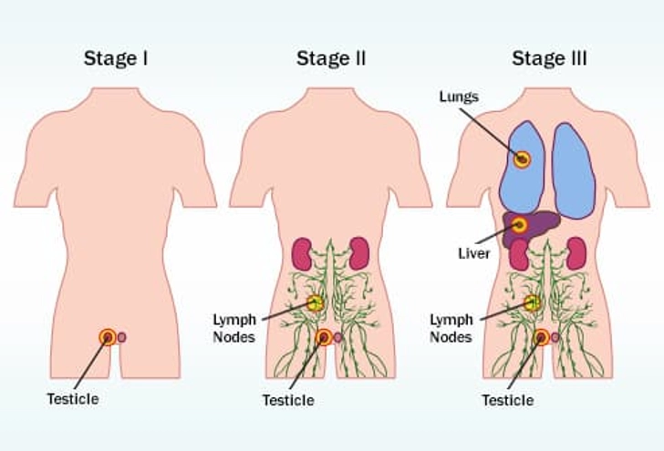 Stages