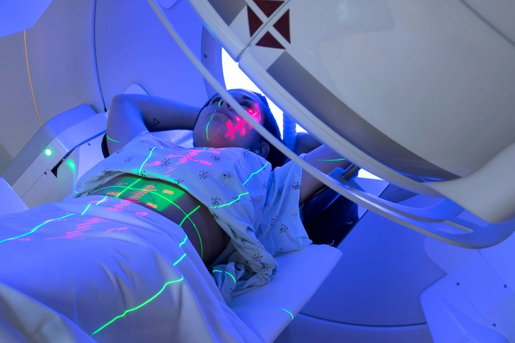 Radiation Radiation